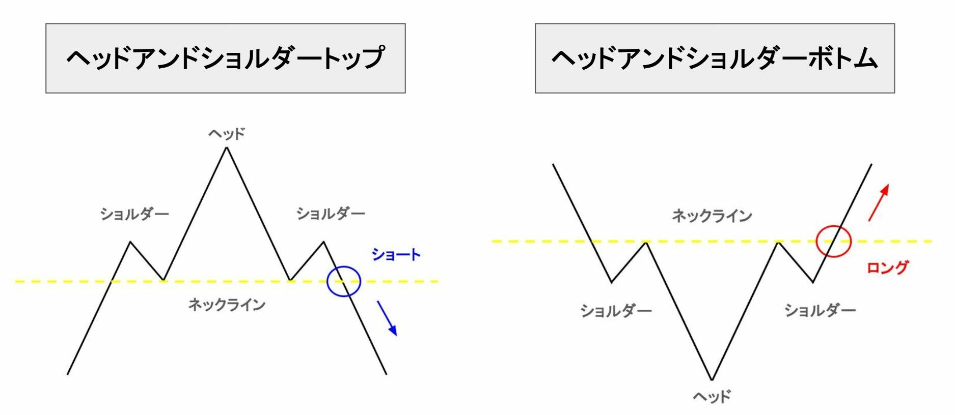 エリオット波動 ヘッドアンドショルダートップ・ボトムの図解